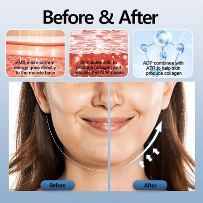 SNORYX™- EMS Smart Anti-Snoring Device