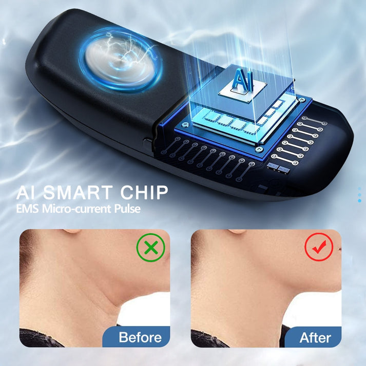 SNORYX™ - EMS Smart Anti-Snoring Device