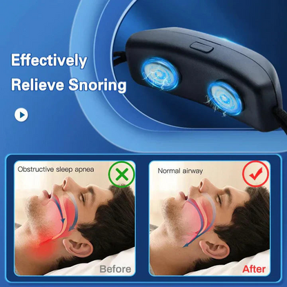 SNORYX™- EMS Smart Anti-Snoring Device